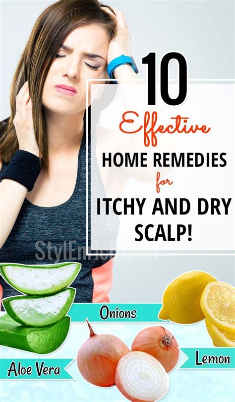 Home Remedies For Itchy Scalp Home Remedies For Dandruff Dry Itchy