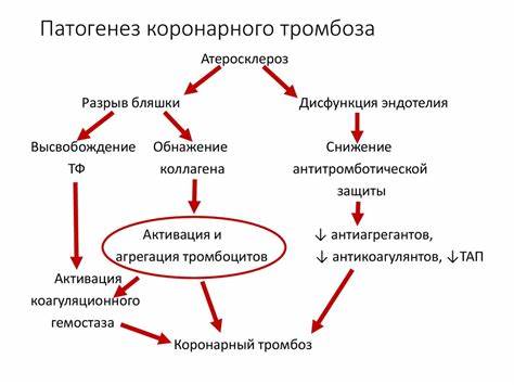 Нестабильная стенокардия диета Острые коронарные синдромы. Инфаркт миокарда и нестабильная стенокардия Острые коронарные синдромы. Инфаркт миокарда и нестабильная стенокардия Нестабильная стенокардия диета