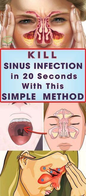 Kill Sinus Infection in 20 Seconds With This Simple Method ...