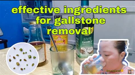 Diyhomeremedy Simpleingredients Diy Home Remedy For Gallstone Youtube