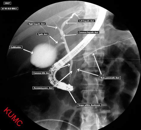 Pin On Radiographic Anatomy