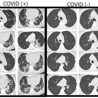 Sample Images Of Ct Scans From Dataset Download Scientific Diagram