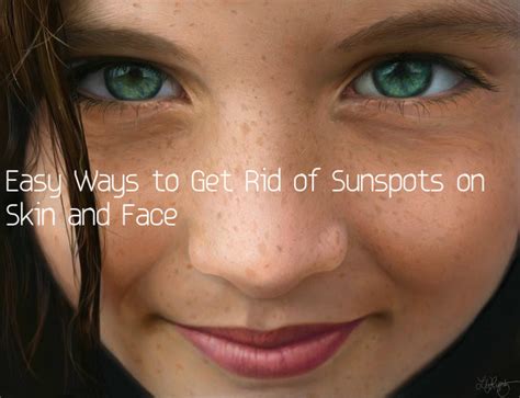 Easy Ways To Get Rid Of Sunspots On Skin And Face Stylish Walks