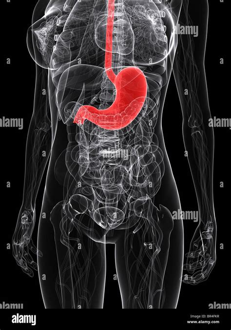 Stomach Metastasis Hi Res Stock Photography And Images Alamy
