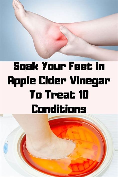 Soak Your Feet In Apple Cider Vinegar To Treat 10 Conditions Apple