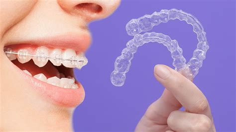 Invisalign Vs Braces Which Is For You Ricci Orthodontics