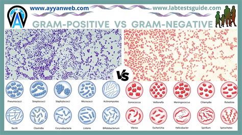Difference Between Gram Positive And Gram Negative Bacteria Lab Tests