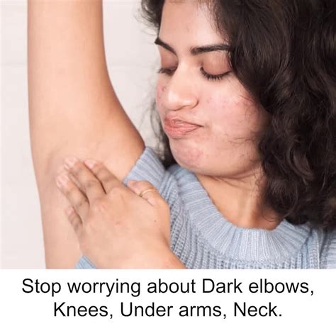 Fixderma Stop Worrying About Those Dark Elbows Knees Facebook