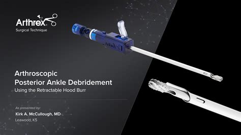 Arthrex Arthroscopic Posterior Ankle Debridement Using The