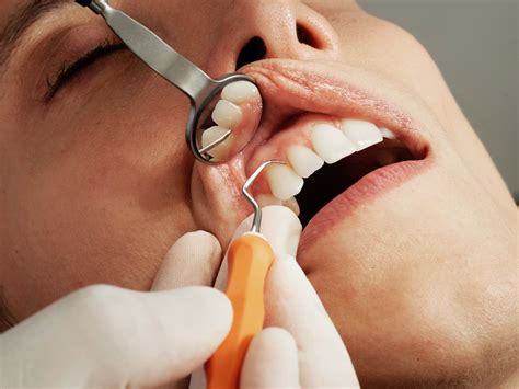La Guía Definitiva De Las Limpiezas Dentales Por Qué Son Vitales Para Una Sonrisa Sana Vida Sana
