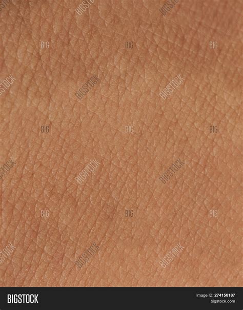 Dark Skin Texture