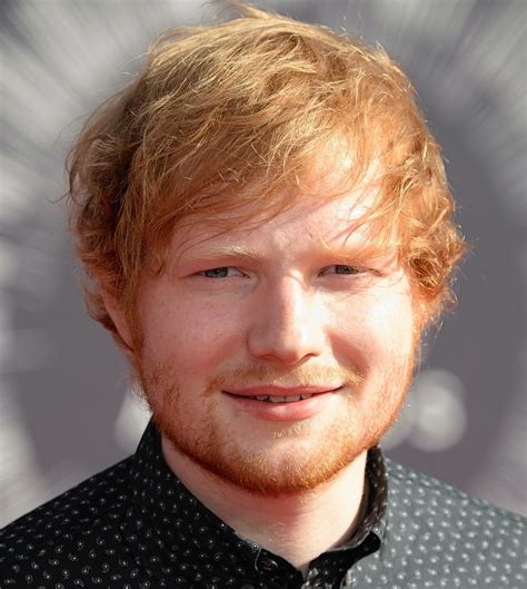 Ed Sheeran 1 Celebrities Hair Transplants