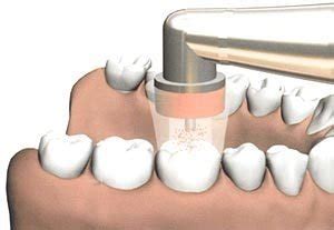 From Our Archives Dental Ozone Simple Safe And Effective Toothbody