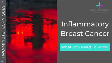 Two Minute Techniques Inflammatory Breast Cancer Youtube