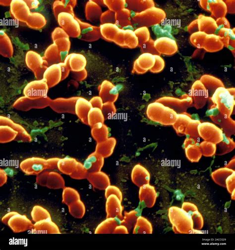 Streptococcus Pneumoniae Análisis Micrografía De Electrones Sem De