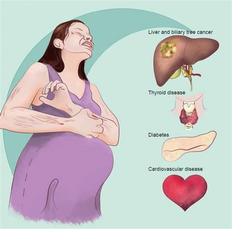 Intrahepatic Cholestasis Of Pregnancy Linked Eurekalert