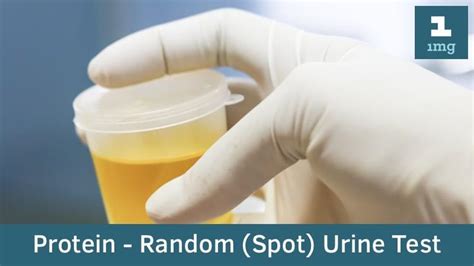 Protein Random Spot Urine Purpose And Normal Range Of Results 1mg