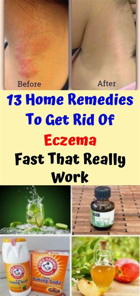Let Start Slim Today 13 Home Remedies To Get Rid Of Eczema Fast That