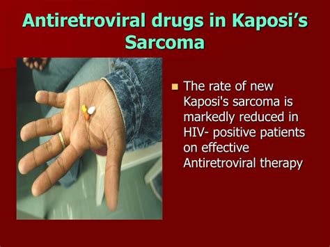 Ppt Kaposis Sarcoma Powerpoint Presentation Free Download Id5841