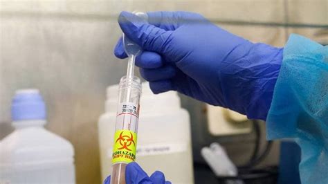 Coronavirus Un Laboratoire De Pau Participe Au Lancement Dun Test De
