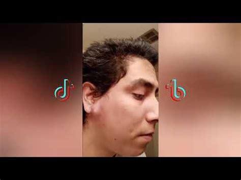 Top Best Pimple Popping Tiktok Videos Compilation Youtube