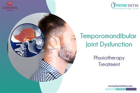 Temporomandibular Joint Tmj Disorders Symptoms And Causes