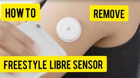 How To Remove The Freestyle Libre Sensor Youtube