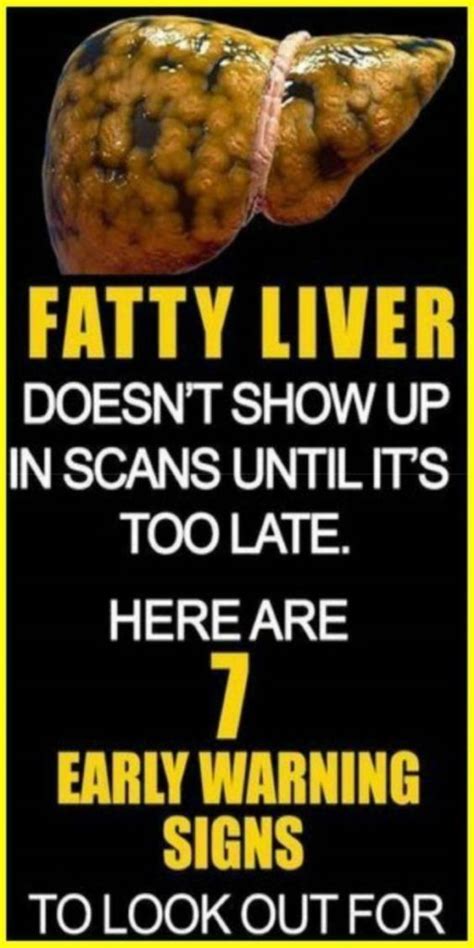 7 Fatty Liver Signs To Watch Out For And How To Treat It Remedies List