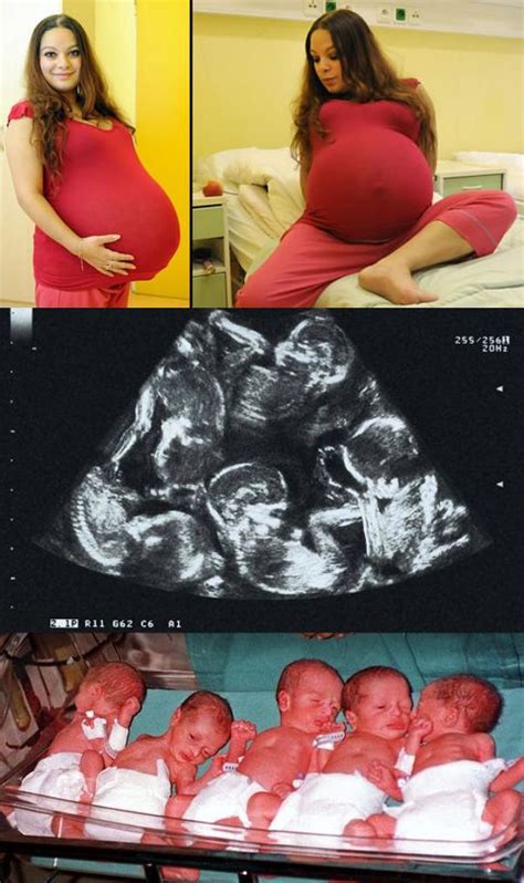 84 Best Sextuplets Septuplets Octuplets Images On Pinterest Multiple Births Triplets And Twins