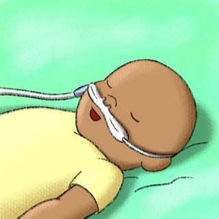 Prongs should not totally occlude nares. October 2019 - High Flow Nasal Cannula in Bronchiolitis ...