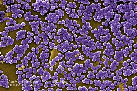 Mengenal Staphylococcus Aureus Bakteri Penyebab Infeksi Yang Mencemaskan
