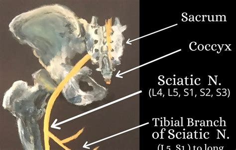 Sciatica Lower Back Pain And The Sciatic Nerve
