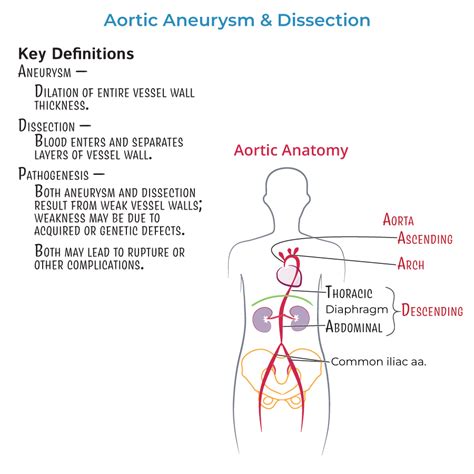 Clinical Pathology Glossary Aortic Aneurysm And Dissection Ditki
