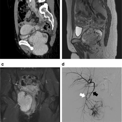 Preoperative Imaging Findings A Preoperative Contrast Mediumenhanced