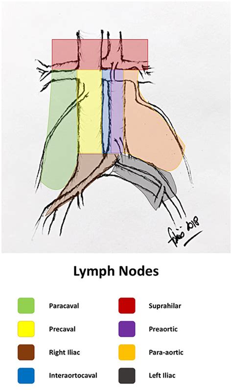 Frontiers The Role Of Lymph Node Dissection In The Treatment Of