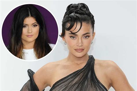 What Plastic Surgery Has Kylie Jenner Had Done