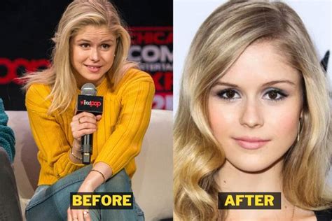 Has Erin Moriarty Undergone Plastic Surgery Before After Photos