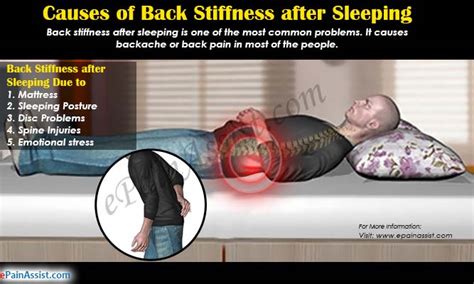 Causes Of Back Stiffness After Sleeping And Its Treatment Exercises 2022