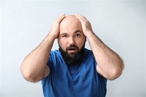 Treating Male Pattern Baldness 6 Proven Methods Health Clarified