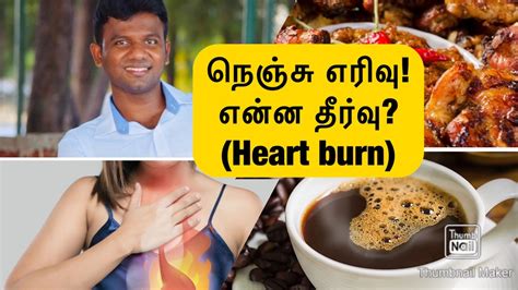 Heart Burn நெஞ்சு எரிவுகுடல் புண்கள் 1