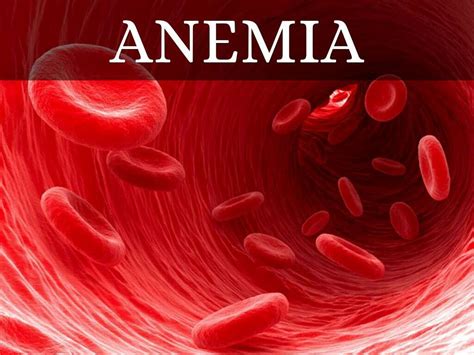 Anemia Symptoms Of Anemia