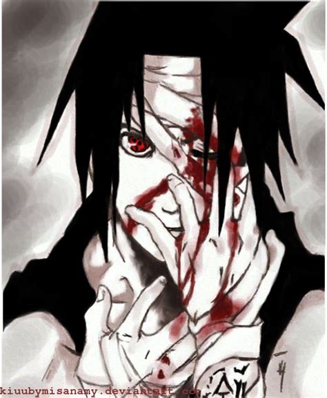 Sasuke Bleeding Eye By Kiuubymisanamy On Deviantart