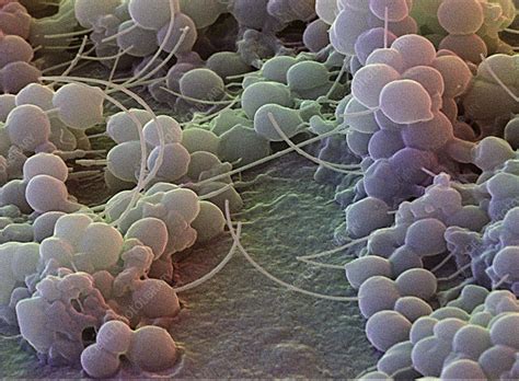 Staphylococcus Epidermidis Bacteria Sem Stock Image B2340111