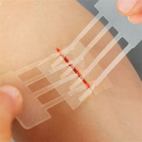 Buy Clozex Emergency Laceration Closures Repair Wounds Without