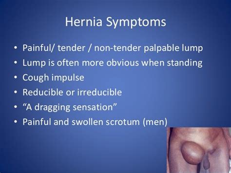 Femoral Hernia Symptoms Men Hernias And Groin Swellings Most