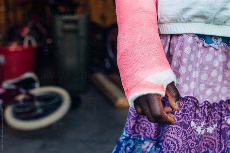 pink cast on a broken arm of an african american girl by stocksy contributor gabi bucataru