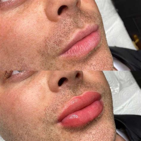 Lip Blushing Before And After Best Examples Of Lip Tattoo