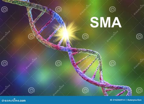 Spinal Muscular Atrophy Sma A Genetic Neuromuscular Disorder Stock