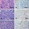 Histological features of tumors from C3(1)/Tag-Pr cells injected s.c ...