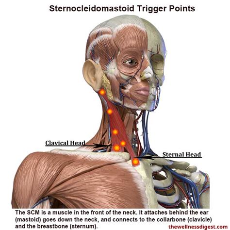 Sternocleidomastoid Muscles Affects Head Eyes Sinus Ears Throat